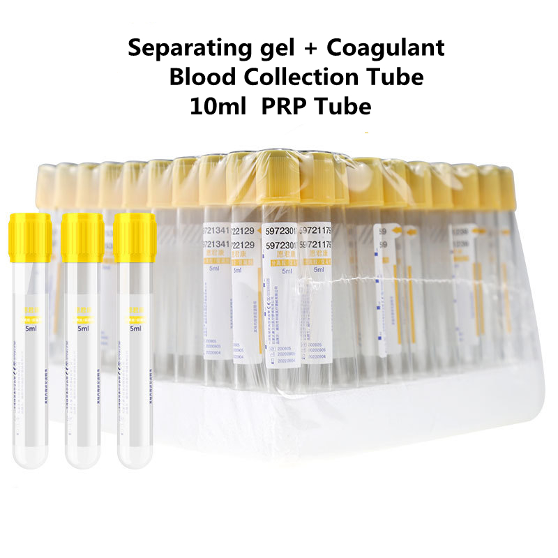 Medical Lab Blood Test - Disposable Vacuum Blood Collection Tube Separation